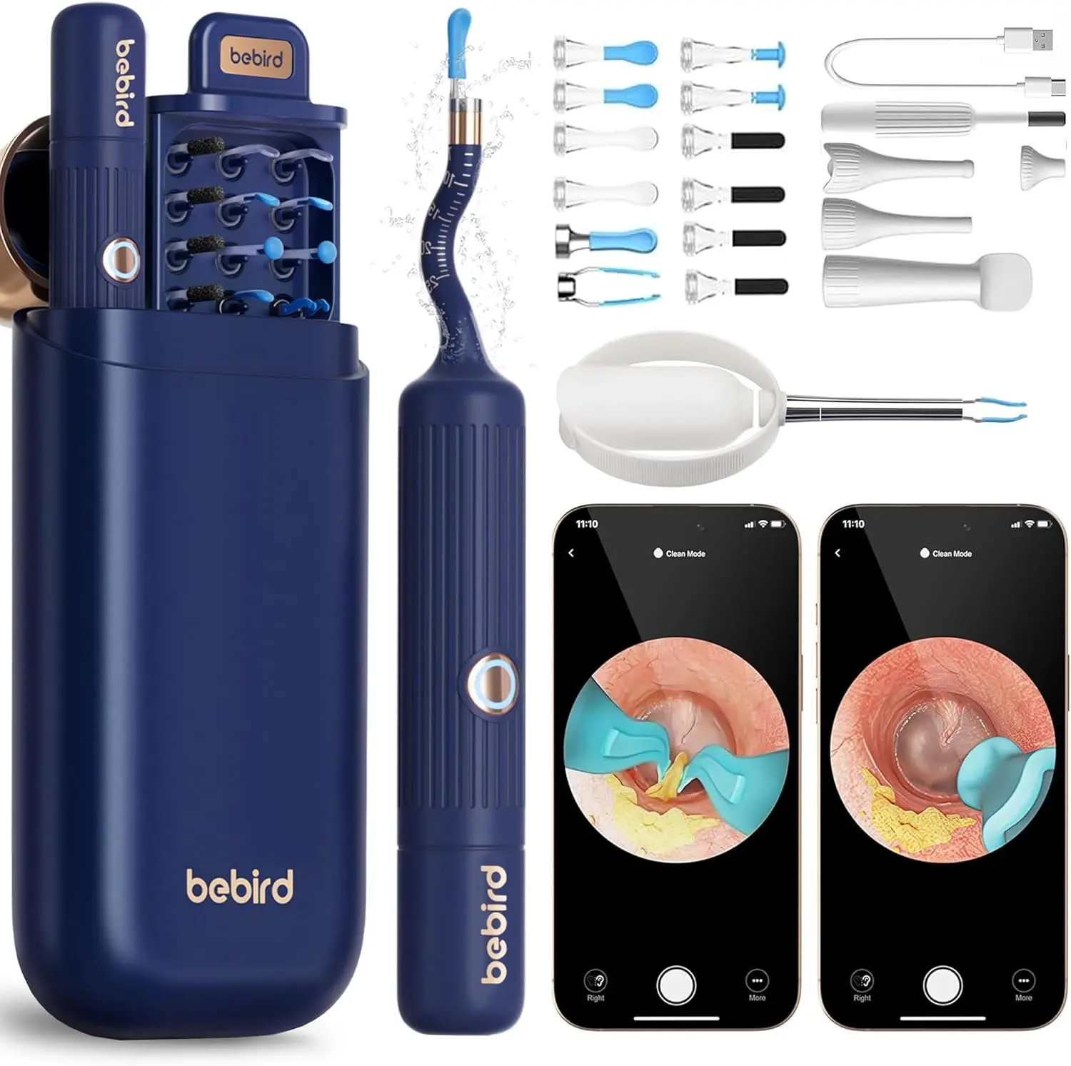 Bebird Earsight Plus E33 Ear Cleaning Earwax Removal Tool Kit, Flexible Otoscope Otoscope  Light, Visual Ear Spoon Wireless  Removal Tweezers for Adults and Kids Intelligent Visual Ear Scoop with Rechargeable EarwaxRemovalKit HD Camera Ear Wax Removal Kit