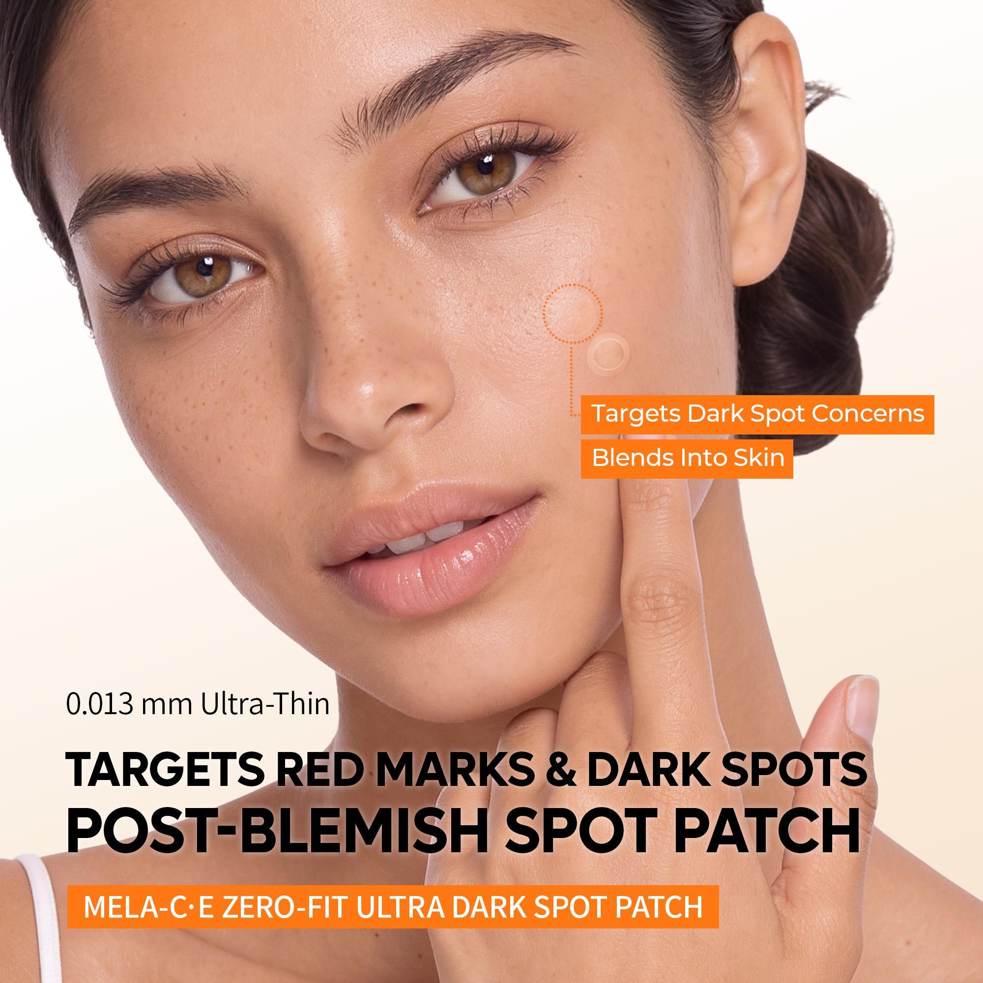 [Dr.Melaxin Official] Zero-Fit Blemish & Dark Spot Patch Duo 72 Patches × 2 | S-ZINC + Mela-C·E Ultra Thin Spot Patches with Salicylic Acid, Acne Care, Sulfur, Vitamin C & Niacinamide