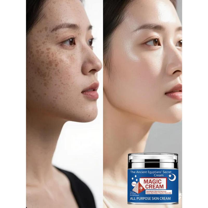 TRSTAY face cream is suitable for various skin types. face cream can moisturize skin, tighten skin, and make skin look brighter