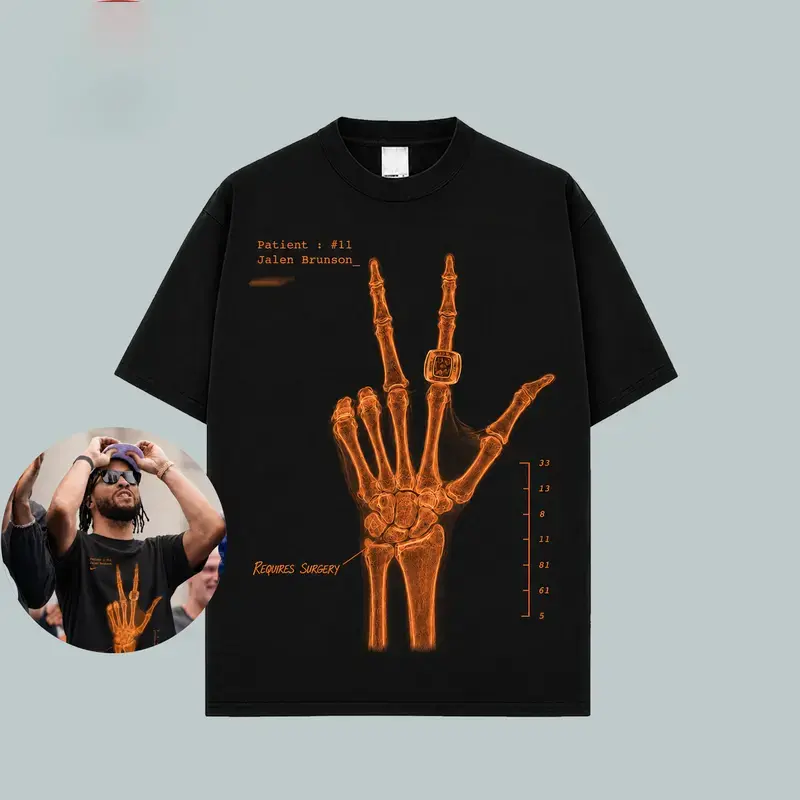 Wrist Surgery X-Ray T-shirt, Basketball Fans Shirt, Basketball Streetwear Tee, Men Women Graphic Cotton Top