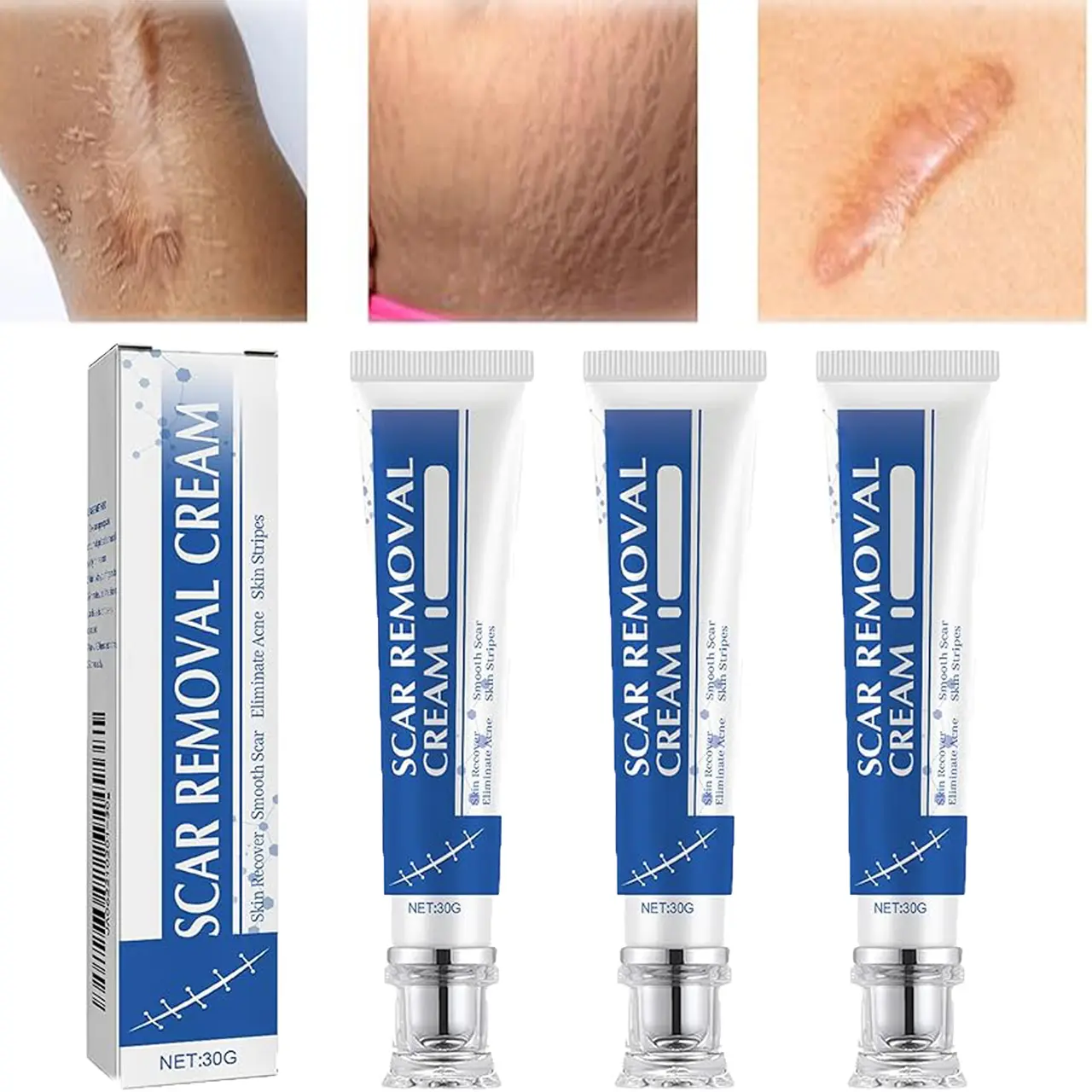Paraben-Free Sensitive Scar Removal Cream 20G - Scar Solution, Keloid Bump Solution for C-Section Marks, Skin Healing Support, Redness Reduction, Essential Hydration, Easy To Use (60-90 Days) (Beauty & Personal Care, Bath & Body Care), Stretch Marks