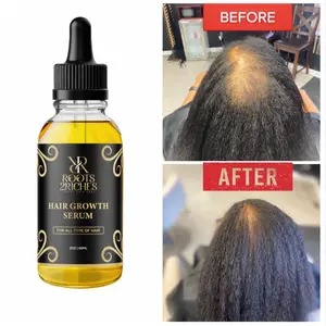 Hair Growth Serum 4oz