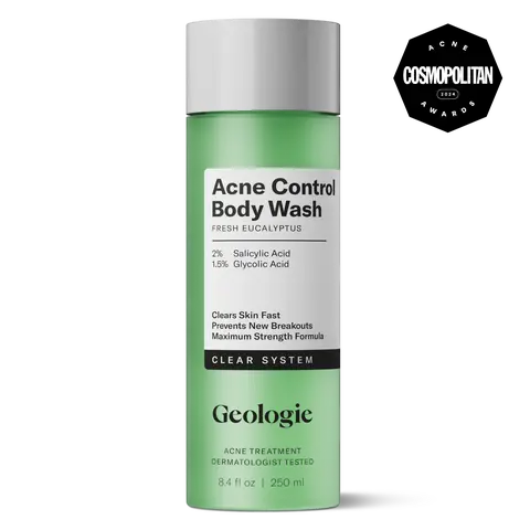 Geologie Acne Control Body Wash | Fresh Eucalyptus | 2% Salicylic Acid + 1.5% Glycolic Acid | Clears Body Acne & Prevents Breakouts | For Men & Women | No Benzoyl Peroxide | 8.4 oz