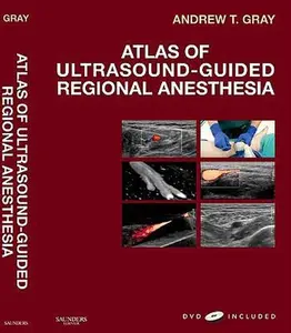 USED-Atlas of Ultrasound-Guided Regional Anesthesia: Expert Consult - Online and Print by Andrew T. Gray MD  PhD (Hardcover)