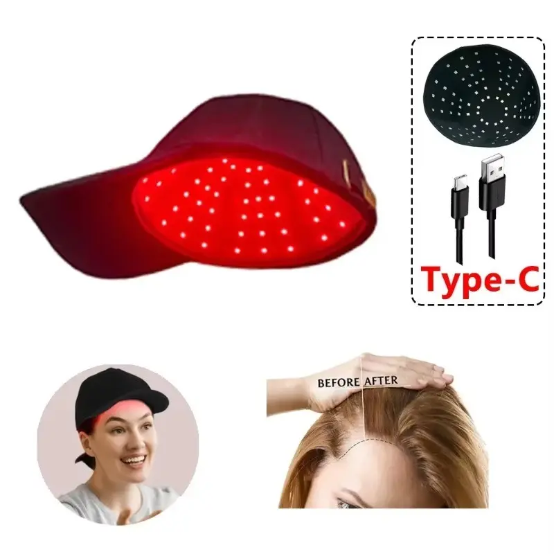LED Light Therapy Cap for Hair Growth, Diode Laser Helmet for Hair Regeneration and Baldness Treatment, New Model Lhm-003, USB Charging, LED Photon Technology, Advanced Technology, Hair Care, Hair Health, Hair Care Solution