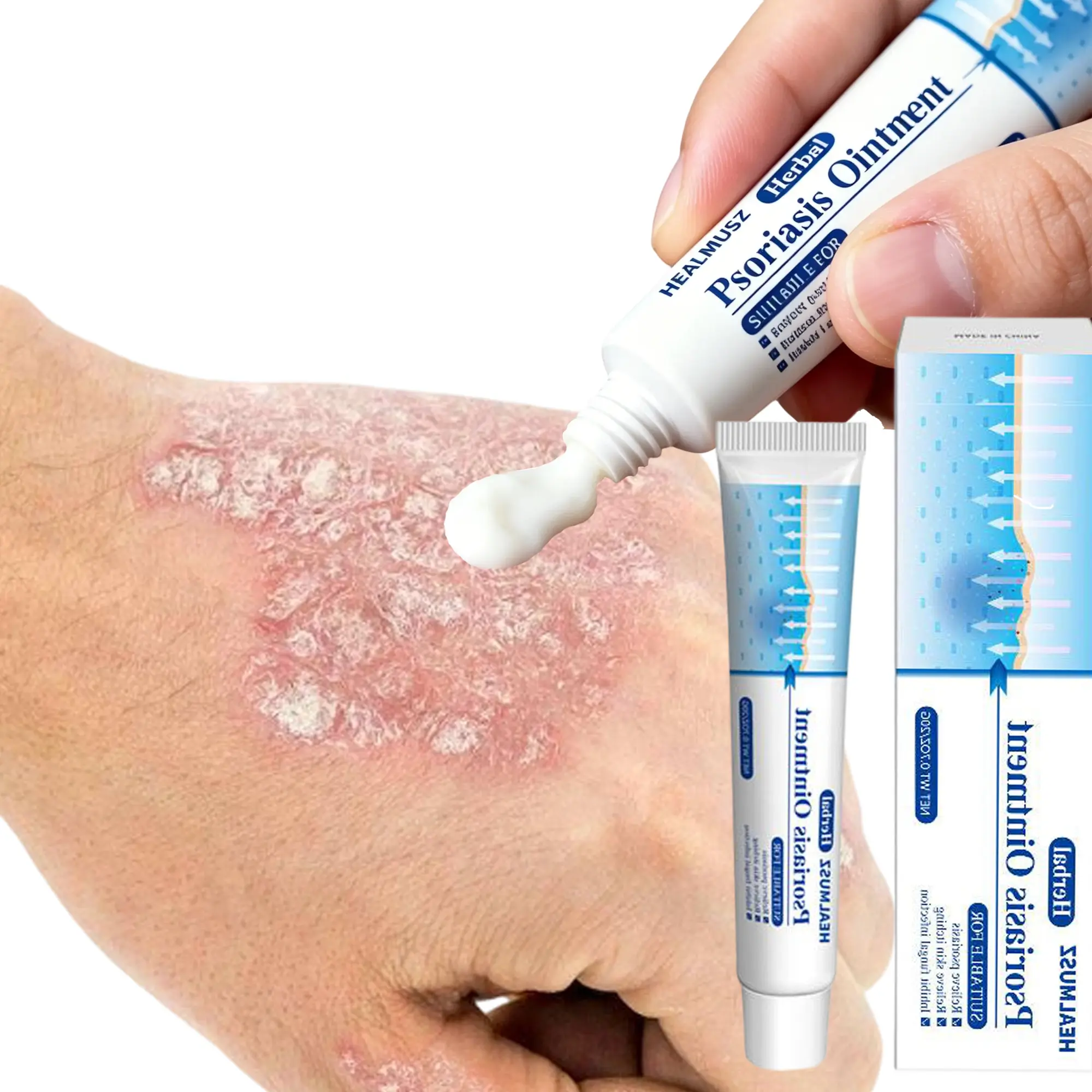 Antifungal & Psoriasis Cream – 100% Natural Plant Formula for Psoriasis, Tinea (Scalp, Body, Groin, Versicolor), Copper Fungus. Fast Relief for Itching, Dryness, Redness. Deep Hydration, Soothing & Non-Recurring– 20g