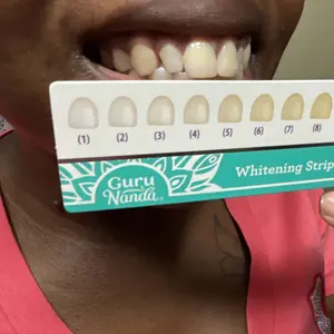 Product Review of GuruNanda Whitening Strips, 7-day treatment (7 Packets - 2 Strips per pack) - Non-Slip, Dry Strip Technology from A**a L**e