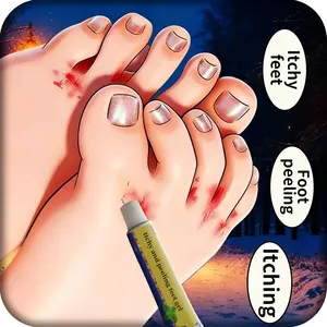 If you’ve been troubled by persistent athlete’s foot for a long time, this antifungal foot cream is exactly what you need. Many people struggle with itchy feet, unpleasant foot odor, sweaty feet, peeling skin, blisters, and dry, cracked heels throughout t