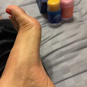 Two for one，Anti-Crack Foot Cream, Cracked Heel Repair Stick | Dead Skin Remover for Dry Feet, Intensive Hydration & Nourishing Treatment for Extreme Cracked Feet Hydrating Hand Balm Hydrating Lotion