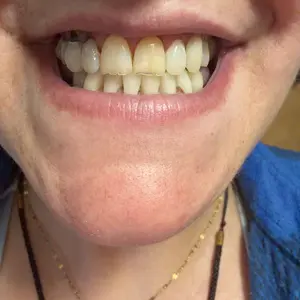 Purple mouthwash customer review photo
