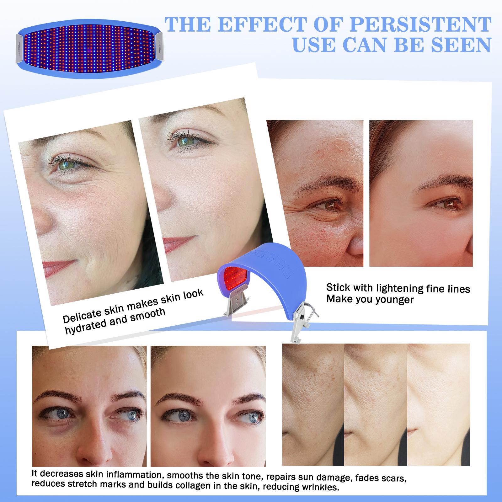 Hydraskincare PDT LED Red Light Therapy for Face Mask Facial Skin Care Rejuvenation Photon Therapy Machine