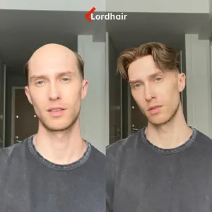 [Lordhair] SuperSkin-V|0.06mm Super Thin Skin V-looped Stock Mens Hair Pieces - Best for new users