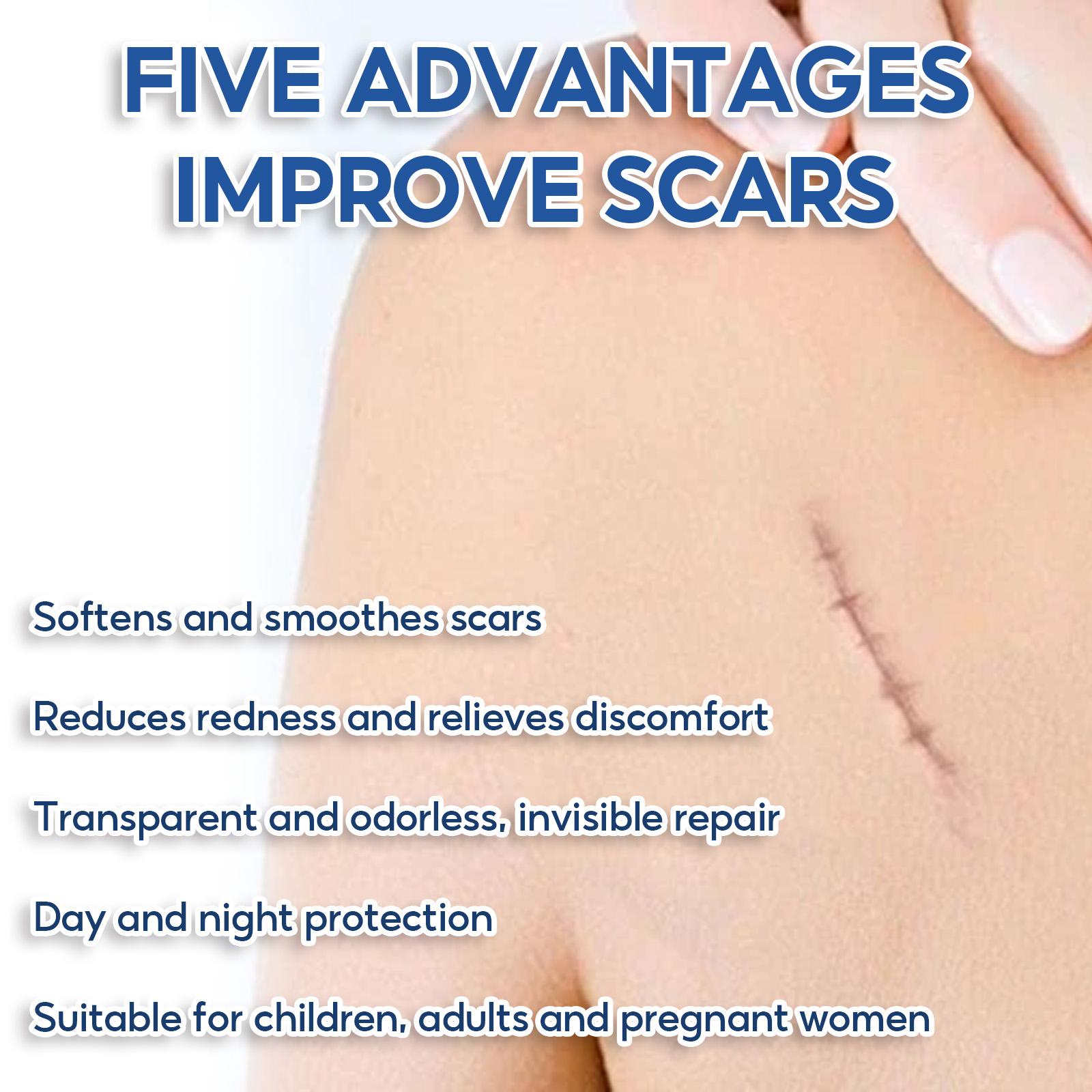 Advanced Scar Removal Cream for Old & New Scars - Silicone Gel Formula for Surgical, Acne, Keloid, Burn & Stretch Mark Repair, Smooths & Hydrates Skin, 30g