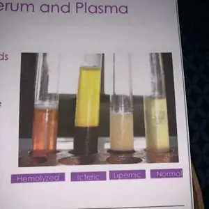 Phlebotomy Study Of Draw study learn different phlebotomy Collection Tubes!