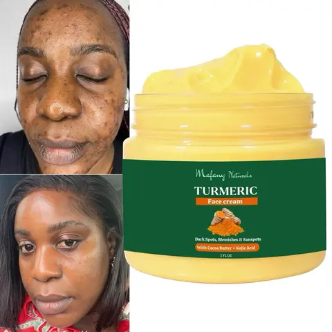 Turmeric Face Cream, Dark Spot Remover, Even, Glowing, Even Skin Tone 2FL OZ