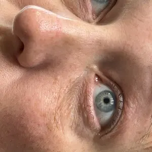 Product Review of Qure Micro-Infusion Anti Wrinkle Patches for Smile Line, Frown lines, Under Eye Bags, Puffiness, Crow's Feet - Retinol, Niacinamide, Caffeine, Peptides - Dissolvable for Overnight Use - 8 Pairs from H**r **