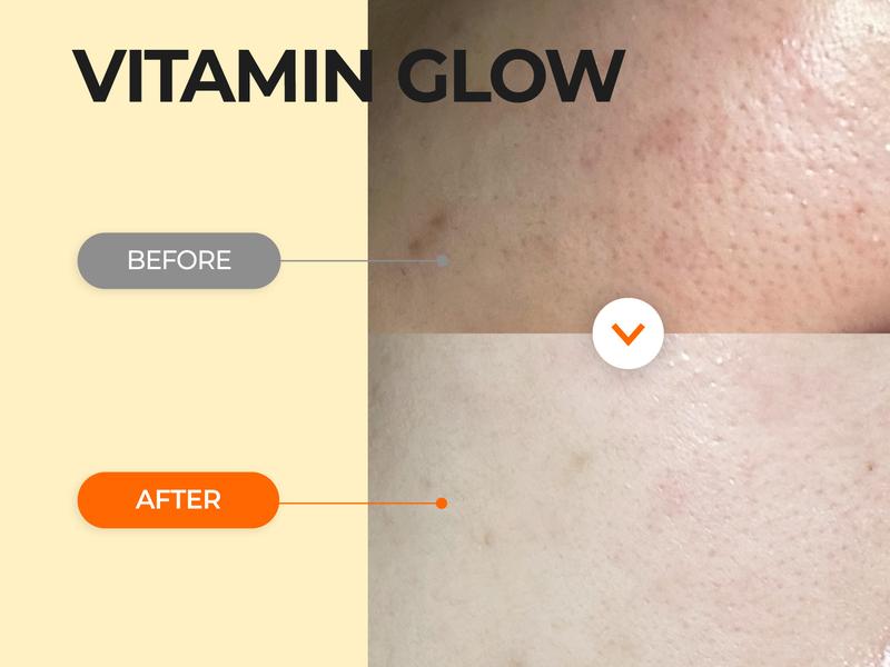 [numbuzin official shop] No.5 Sheet Mask | Vitamin Spotlight Sheet Mask | 4 Sheets