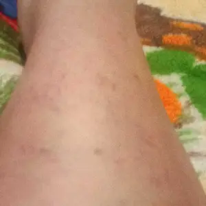 Product Review of HALLUSA NATURAL HALLOSMINE 300 Mg Diosmin Circulation 60 Capsules Gluten-Free Organic GMO-Free Sugar-Free Supplement for Healthy Circulation & Veins Health Made in USA Dietary from C**a R**z