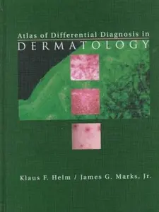 USED-Atlas of Differential Diagnosis in Dermatology by James G. Marks MD (Hardcover)