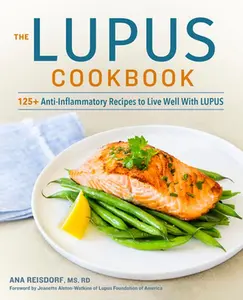 The Lupus Cookbook: 125+ Anti-Inflammatory Recipes to Live Well with Lupus -- Ana Reisdorf - Paperback