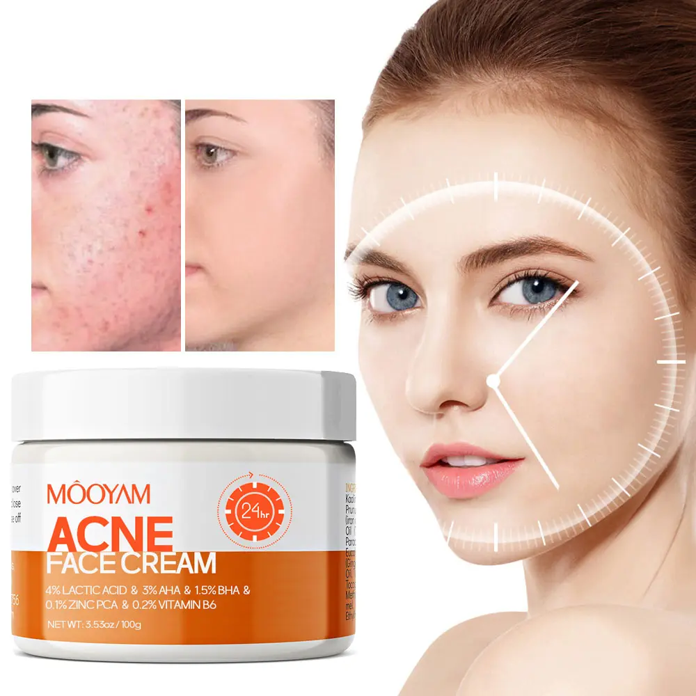 MOOYAM 100ml Acne Scar Cream, Centella Asiatica & Snail Repair Treatment with Salicylic Acid, Fragrance-Free, Paraben-Free, Healthcare Solution for Sensitive Skin Teenagers, Acne Marks, Therapeutic