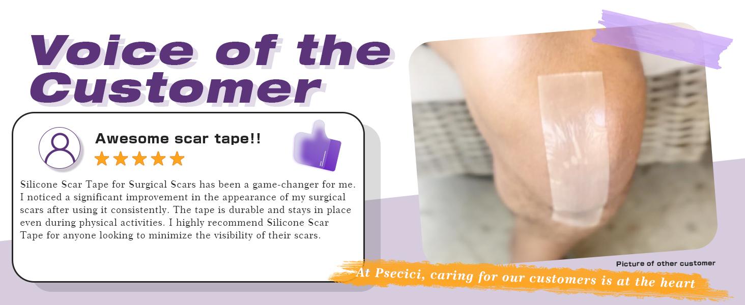 Silicone Scar Sheets,Silicone Scar Tape,Silicone Scar Removal Strips for Surgical,C-Section,Tummy Tuck,Keloid Scars (1.6"X 59" Roll-1.5M) Keloid Bump Removal