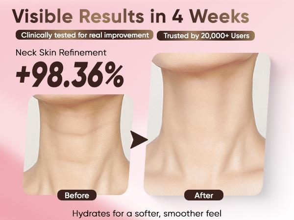 Misoour Neck Mask Set:Collagen Peptide Anti-Wrinkle Neck Mask + Astaxanthin Firming & Smoothing Serum|Reduce neck wrinkles, Moisturize and brighten,Firm and lift#TikTokShopBlackFriday Misoour Neck Mask Set:Collagen Peptide Anti-Wrinkle Neck Mask + Astaxanthin Firming & Smoothing Serum|Reduce neck wrinkles, Moisturize and brighten,Firm and lift#TikTokShopBlackFriday