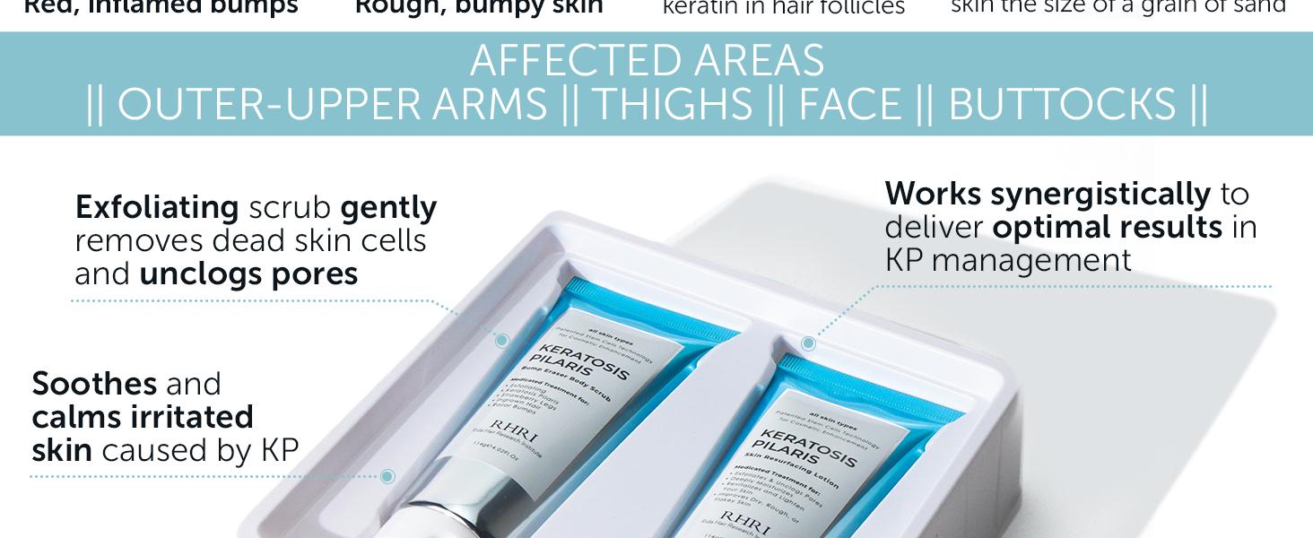 KP Bump Eraser Body Set with 10% AHA | Keratosis Pilaris Treatment | Keratosis Pilaris Lotion | Exfoliating Body Scrub | Ingrown Hair Treatment | Bundle Set for Bump, Strawberry Legs, Redness, Dryness KP Bump Eraser Body Set with 10% AHA | Keratosis Pilaris Treatment | Keratosis Pilaris Lotion | Exfoliating Body Scrub | Ingrown Hair Treatment | Bundle Set for Bump, Strawberry Legs, Redness, Dryness