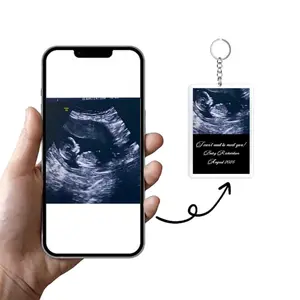Personalized Ultrasound Photo Keychain: Acrylic Bump Keyring