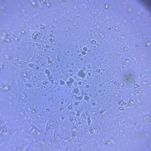 Magnifier Pro Disposable Clear field of view Private and easy to use Disposable lens (reusable base)