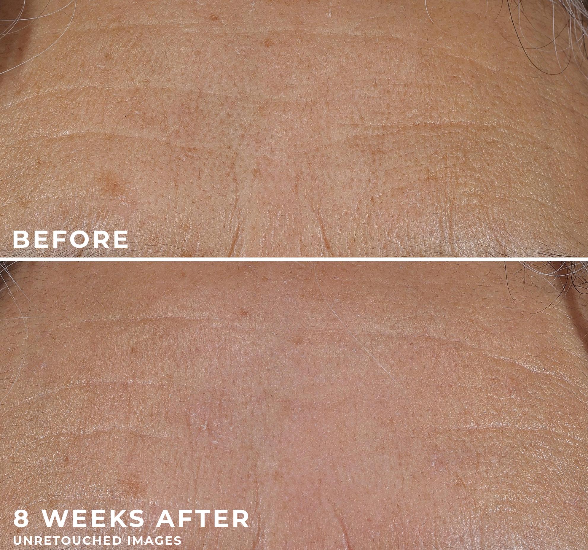 RETINOL CORREXION® Deep Wrinkle Rich Cream RETINOL CORREXION® Deep Wrinkle Rich Cream