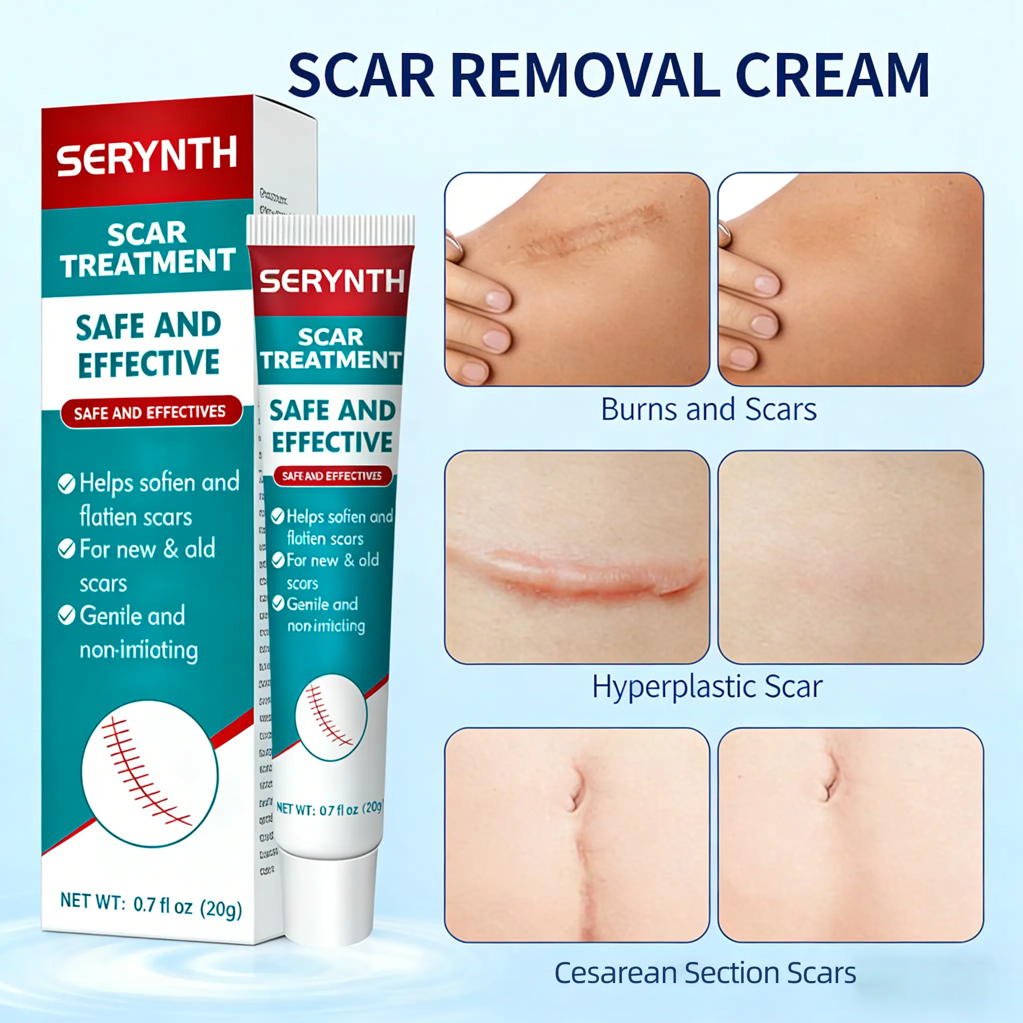 Scar Cream，Professional Scar Removal Cream for Surgical Scars,Stretch Mark, Keloid Bump, C-Section, Scars of Burns and Injuries,Old and New Scars
