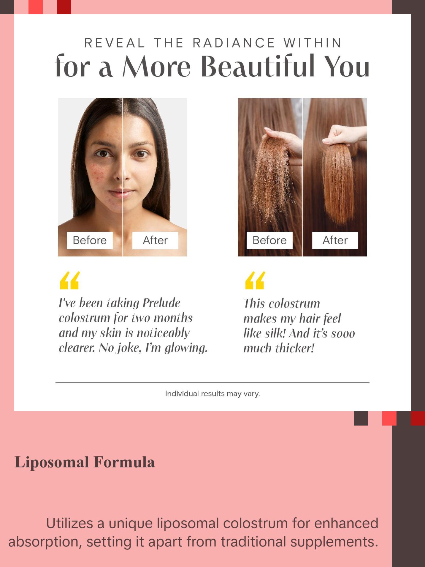 Colostrum Gummies for Skin Health, Joint Support & Collagen Boost – Dietary Supplement for Hair, Fitness & Wellness Healthcare Edible Colagen Nail Bathroom Colostrum Gummies for Skin Health, Joint Support & Collagen Boost – Dietary Supplement for Hair, Fitness & Wellness Healthcare Edible Colagen Nail Bathroom