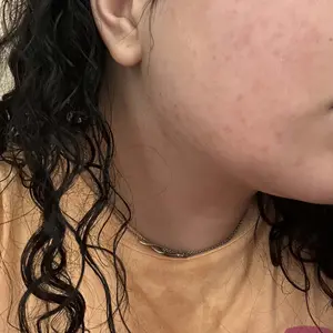 Product Review of Lion Pair Acne Cream Acne Treatment Pimples Removal Cream Pair Acne Creamy Foam Facial Wash Gentle Antibacterial from I**️