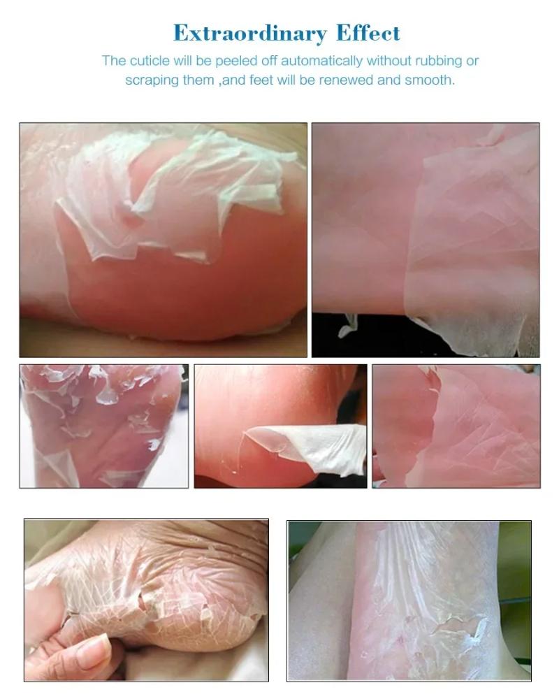 Exfoliating Foot Mask Pedicure Socks Dead Skin Remover for Heels Feet Peeling Callus Softening Smoothing Hydrating Botanical Extract Nourishing Foot Care Treatment Routine Unisex