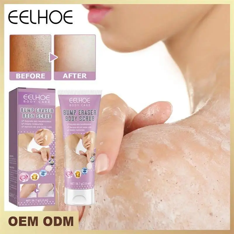 Gentle Body Scrub Cream for Body Care, Mild Formula to Address Hair Follicle Keratinization, Remove Dead Skin, Unblock Pores, Moisturize, Hydrate, Restore Strawberry Legs and Repair Skin, Moisturizer, Hydrating, Skin Repair