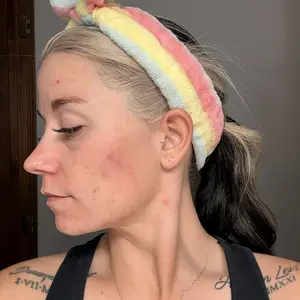 Product Review of [medicube] Affordable Glass Glow Skincare Set | Includes 8 products for Gentle Skin Glow Routine from M**🖤