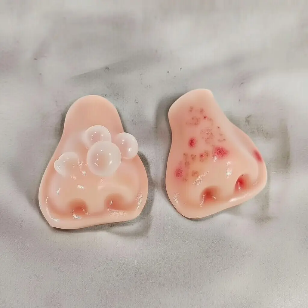 Viral Pimple Popping Toy - Satisfying Stress Relief Squeeze Fidget Realistic Silicone Acne Popper Fun Novel Gift for Adults & Teens