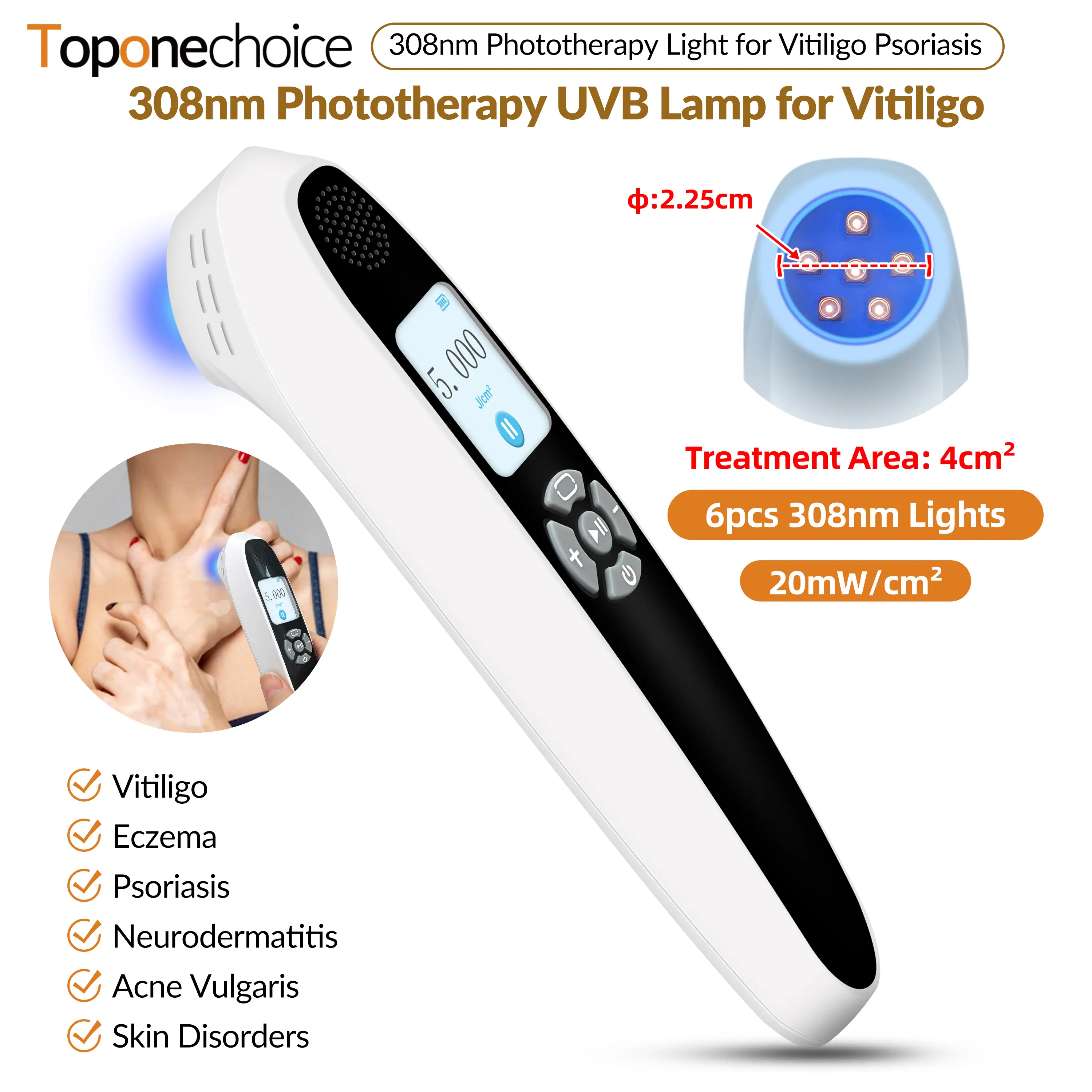 Toponechoice 6 Diodes 308nm UVB Excimer Phototherapy Device, 20mW/cm² High Energy Density, Handheld Blue Light Skin Treatment, Targeted Therapy for Vitiligo, Psoriasis, Eczema, Atopic Dermatitis, Portable Home Use for Skin Disorders