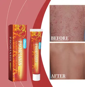 All-Natural Oil-Infused Dermatitis & Eczema Care Ointment, Antifungal Cream & Mist Spray - Healing Skin Repair, Psoriasis Relief, Tinea Cruris/Tinea Corporis Treatment, Rapid Irritation Soothing (Outdoor Use)
