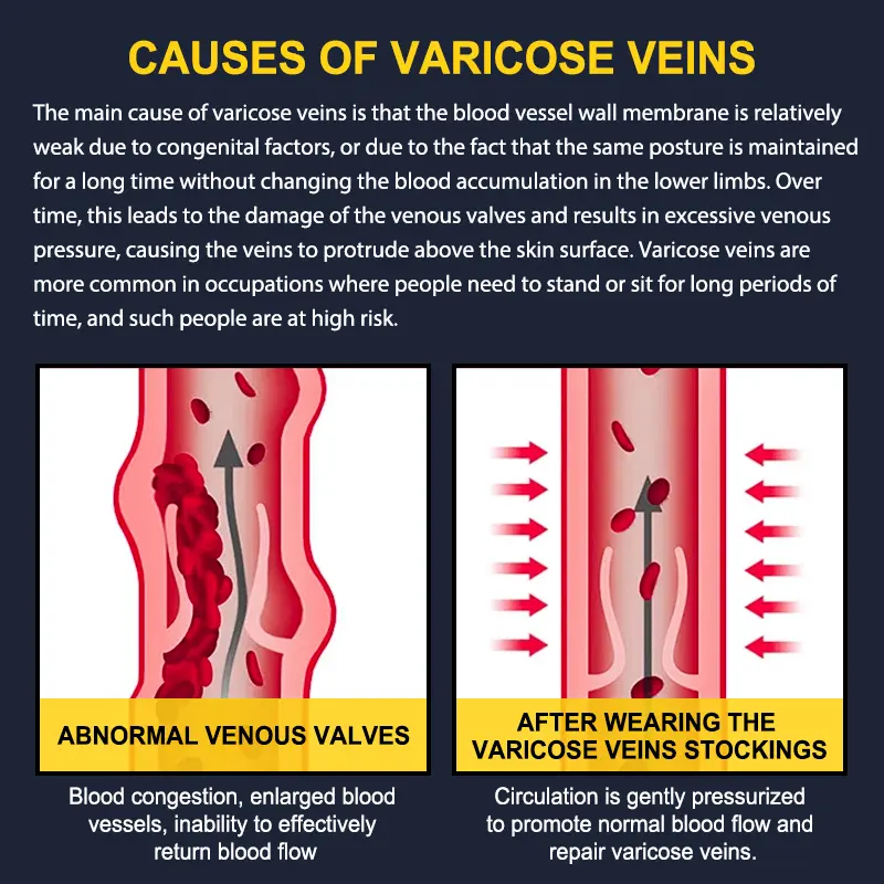 Product Introduction of Tinylemon 3 Pairs Calf Compression Sleeves 20-25mmHg for Women Men Leg Support Running Shin Splints Relief Knee Saver Wellknee Plaster Black Healthcare Tool Patellaband 17