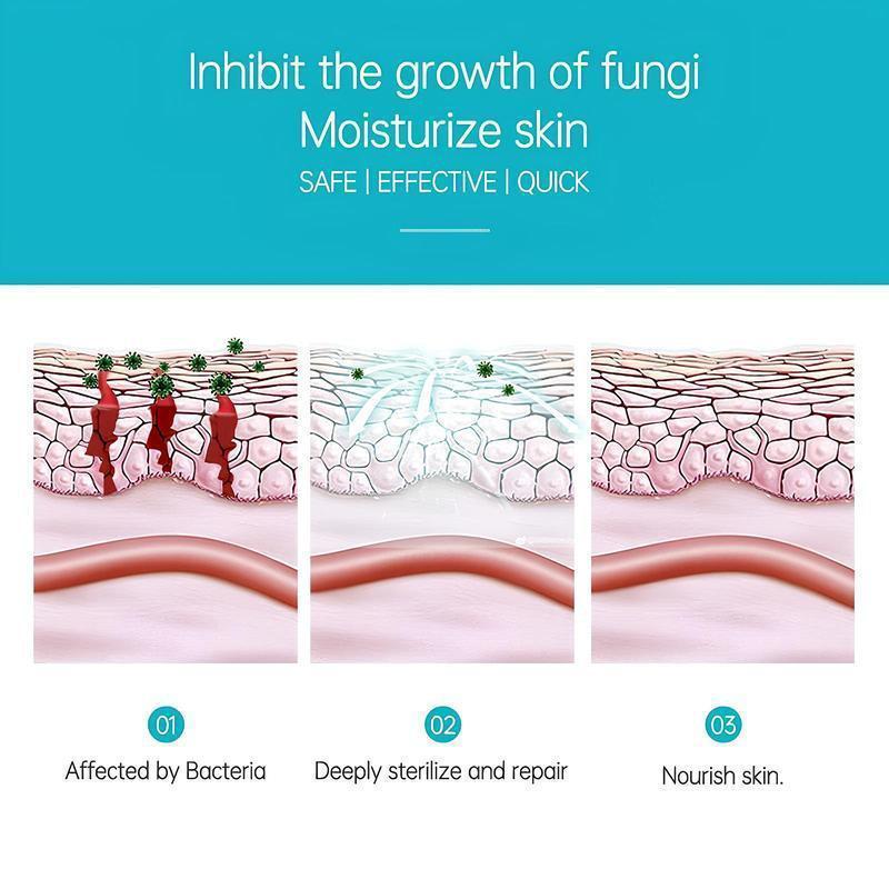 Premium All-Natural Herbal Soothing Cream for Psoriasis Eczema Dry Sensitive Skin Relief Plant-Based Itch Treatment Balm for Mosquito Bites 30g Hypoallergenic Skin Lotion