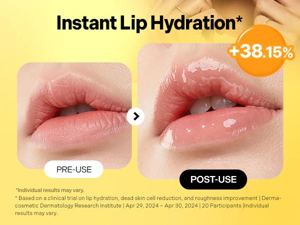 [Torriden Official] SOLID IN Lip Essence 11 ml / 0.37 fl. oz. | Smoothing & Hydrating Lip Care, Lip Hydration, Flake Care, Texture Smoothing with 5D Multi Ceramide