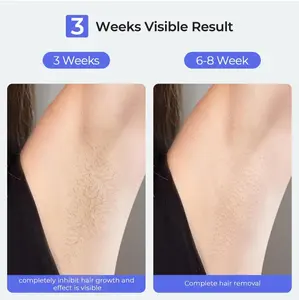 LUBEX Painless Sapphire Ice Cooling IPL Laser Hair Removal Device for Women and Men - Comfort hairclipperkit