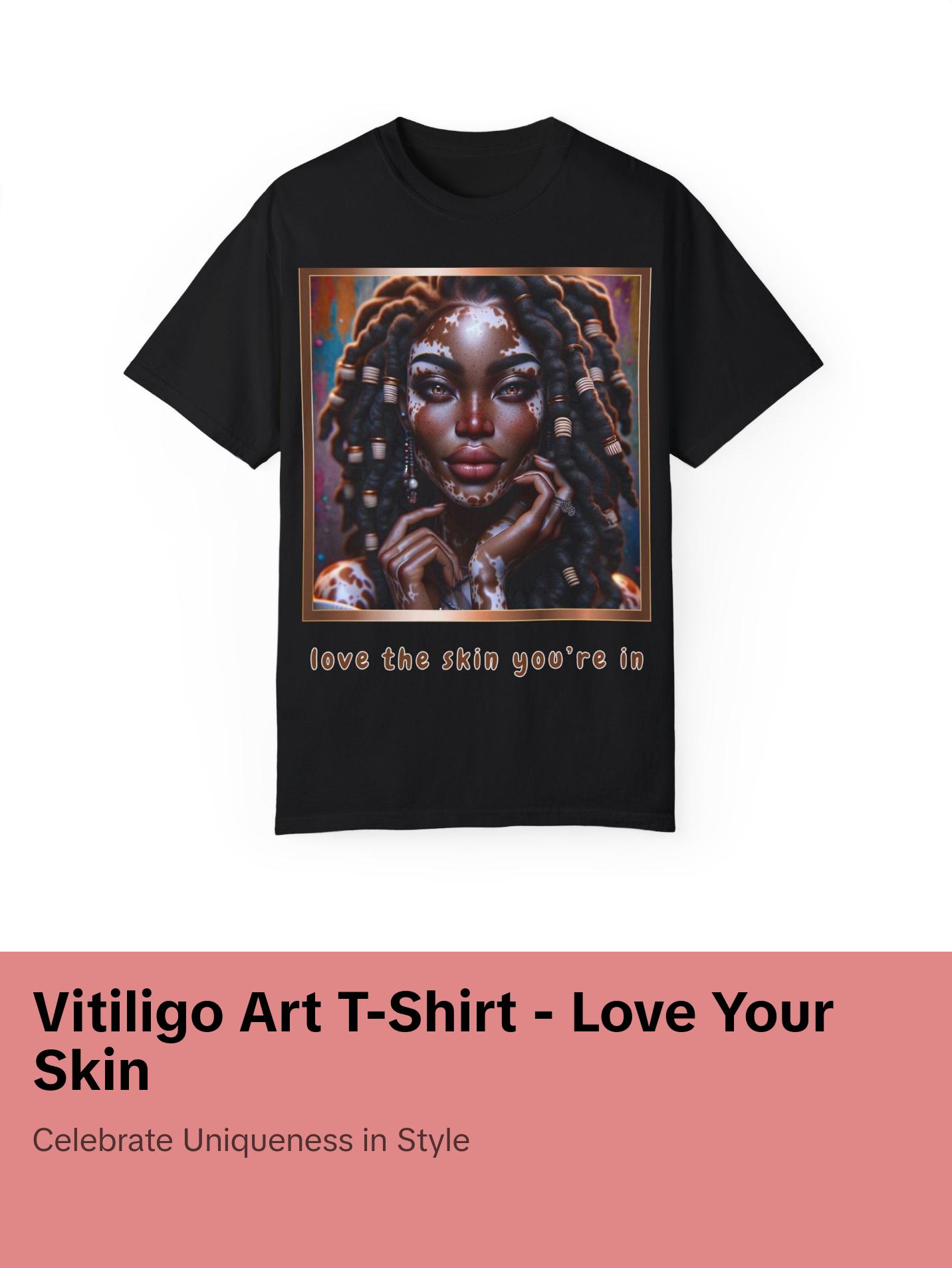 Exquisite Expressions: Celebrating the Unique Beauty of Vitiligo T-Shirt, Love the skin you're in Womenswear Casual Fashion Comfort Streetwear
