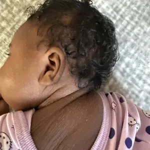 PEGO Baby Eczema Cream - Multi-Purpose Baby Eczema Cream, Soothing and Moisturizing Kids Body Cream, Relieves Skin Discomfort, Natural Skin Care Cream, Suitable for Sensitive Skin, Dry Skin, Rashes, and Irritation, 3.38 oz.