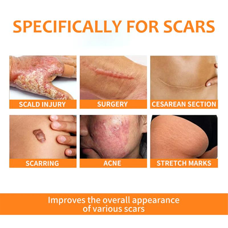 Ximonth Skin Repair Pen with Aloe Vera Extract & Elastic Peptide for Fade Pregnancy Scars Burns Smooth Skin Scar Treatment Youth Enhancer