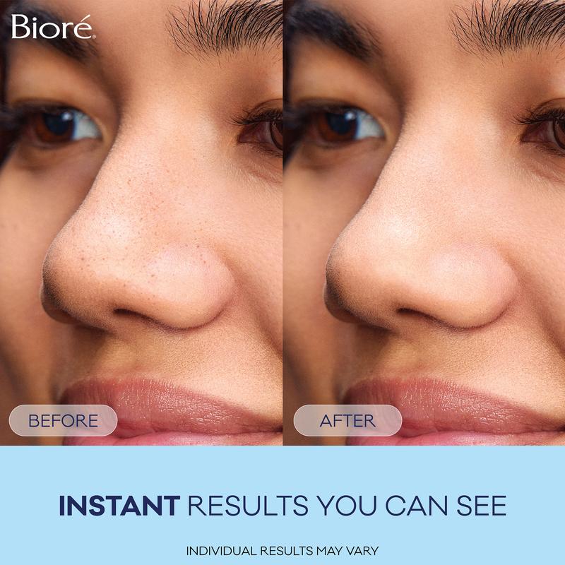 Bioré Skincare Original Deep Cleansing Pore Strips, Blackhead Removal Nose Strips, Instant Pore Unclogging, Oil-Free, Non-Comedogenic, 8-Count Pack