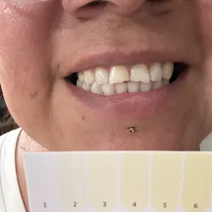 DRDENT Purple Teeth Whitening Strips - 7/21 Whitening Sessions - Safe for Enamel - Non Sensitive Teeth Whitening - Peroxide-Free