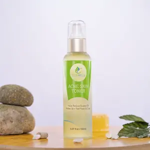 Acne Skin Toner